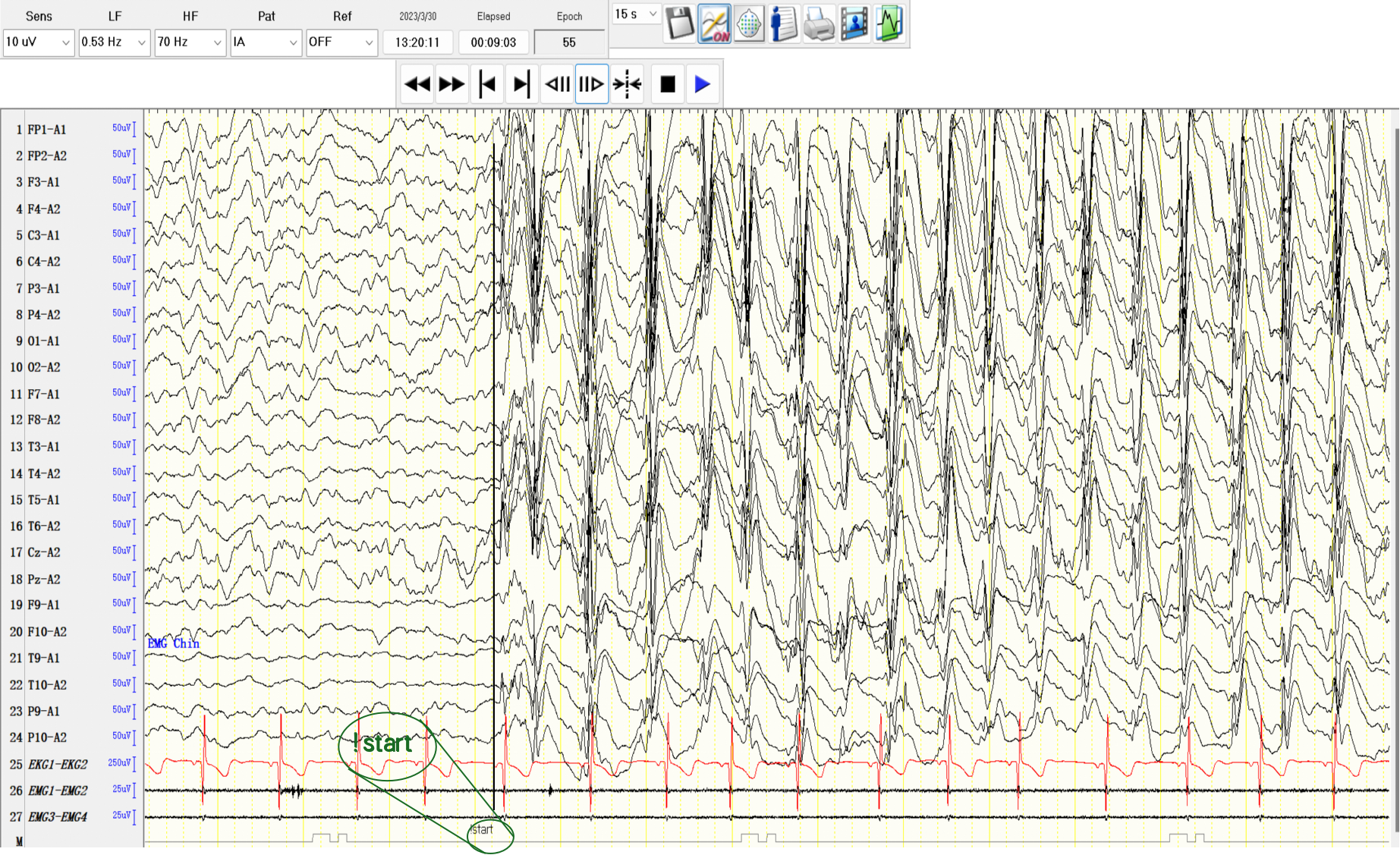 Dataset sample case 1