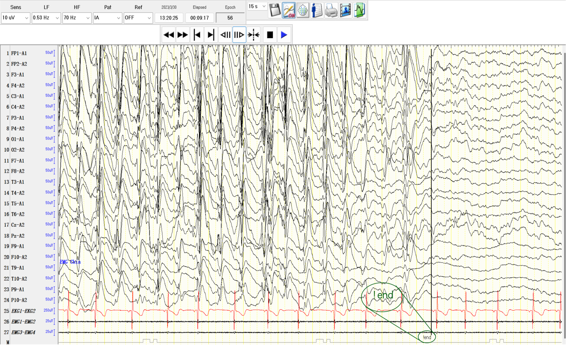 Dataset sample case 2