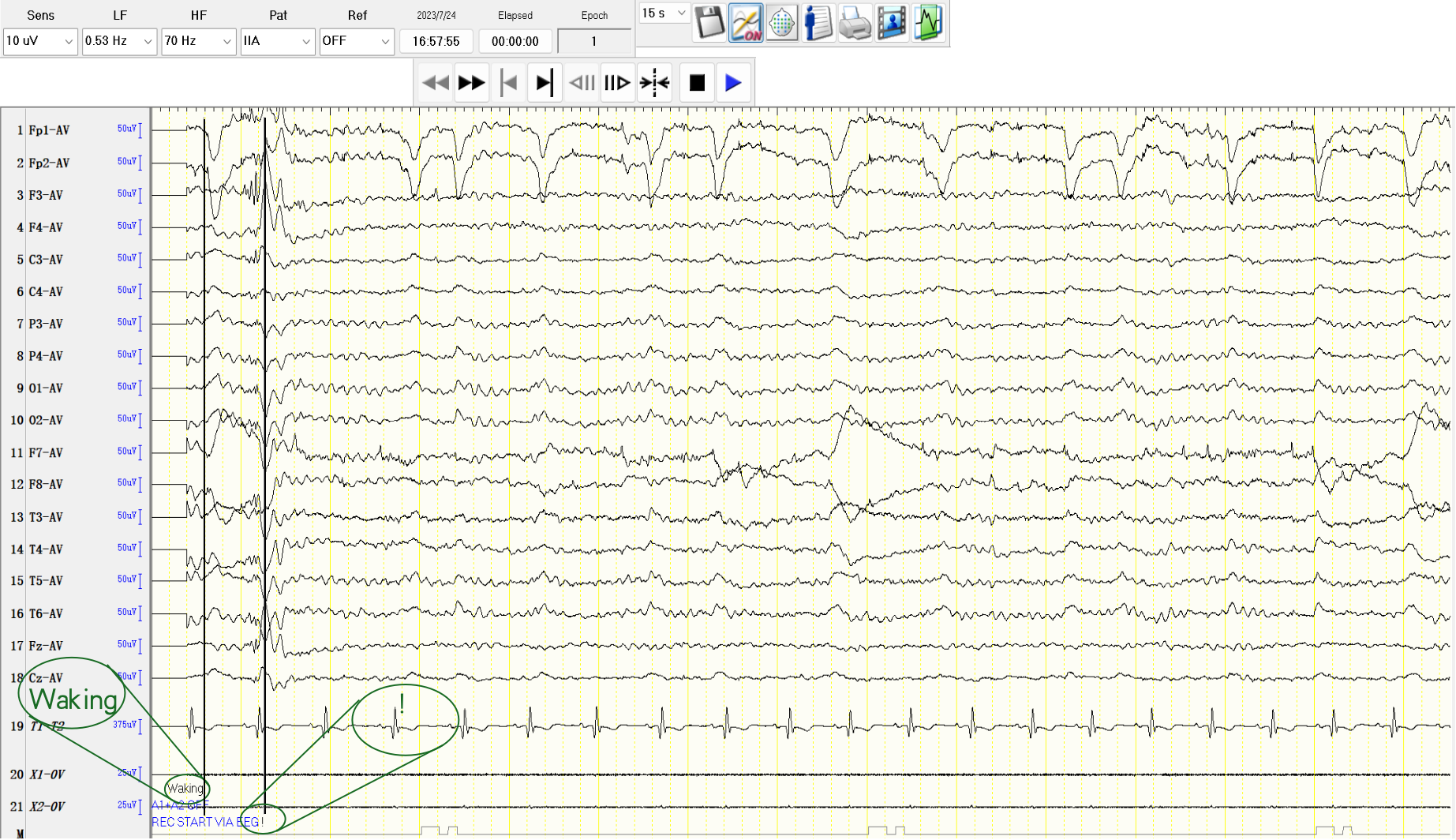 Dataset sample case 3