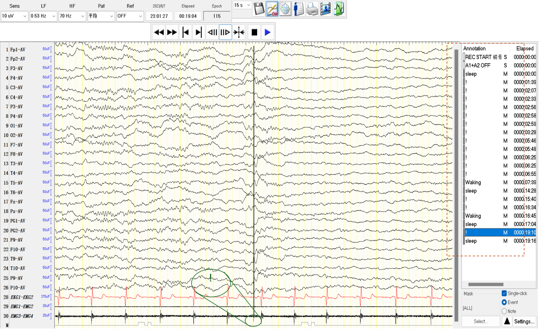 Dataset sample case 4