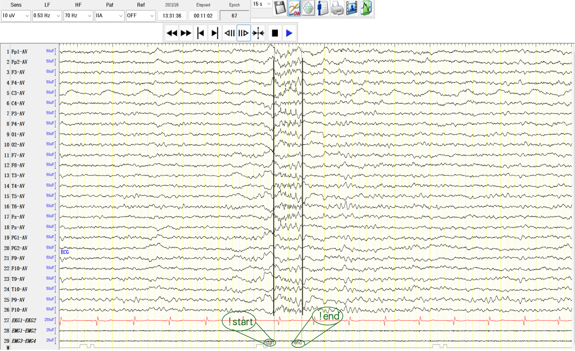 Dataset sample case 5