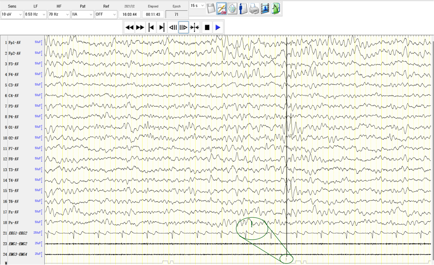 Dataset sample case 6
